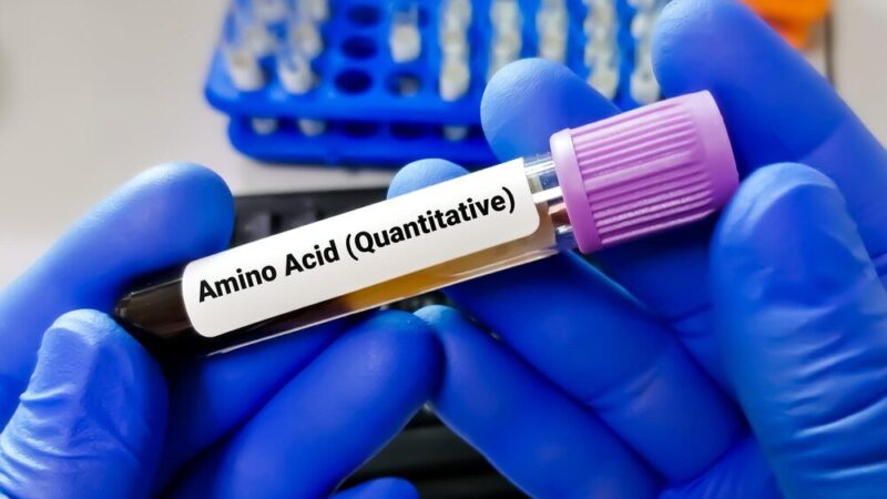 SARM-y na redukcję: które są najlepsze?